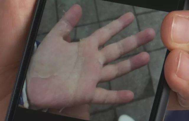 竟有幼兒園用消毒水給幼兒洗手，漓峰提醒：正確使用免洗洗手液