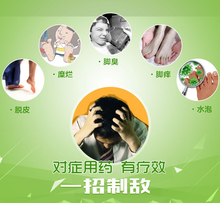 足之友-腳氣克星拒絕香港腳