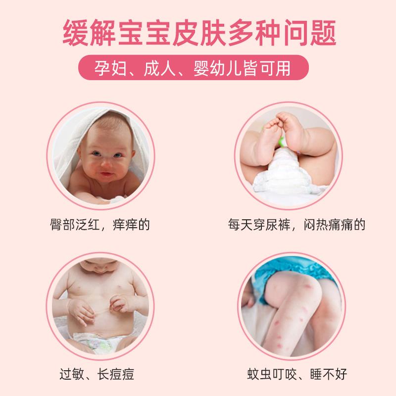 什么情況下可以  給寶寶涂爐甘石洗劑？